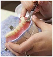 denture 3 denture 3