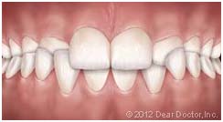 ortho 2 ortho 2