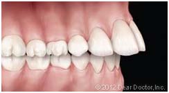 ortho 4 ortho 4