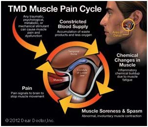 tmd 3 tmd 3