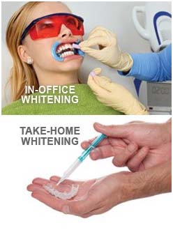 white 1 white 1
